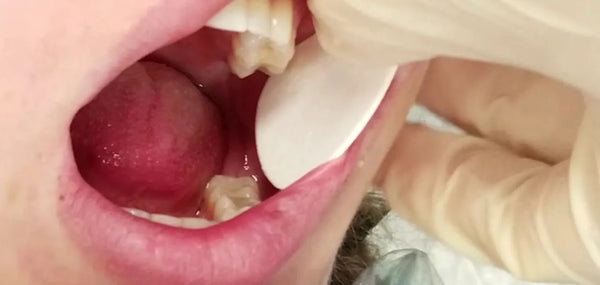 Cheek Dry Guard