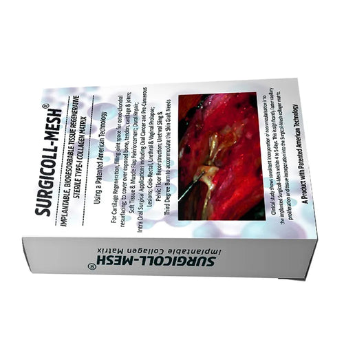 Advance Biotech Surgicoll Mesh - Absorbable Collagen Hemostatic Mesh