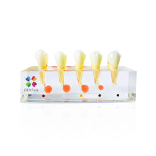 iDENTical Endodontic Treatment Model (M4007-2) Buy Dental products Online DentalMyntra