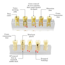 iDENTical Root Canal Model M4012 Buy Dental products Online DentalMyntra