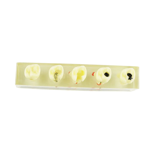 iDENTical Root Canal Model M4012 Buy Dental products Online DentalMyntra