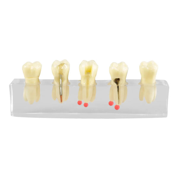 iDENTical Root Canal Model M4012 Buy Dental products Online DentalMyntra