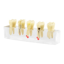 iDENTical Root Canal Model M4012 Buy Dental products Online DentalMyntra