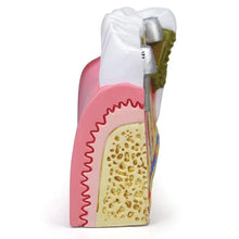 iDENTical Diseased Teeth and Gums Model M4029