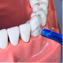 Youni Stamp 5 Mini Kit for Occlusal Restorations 