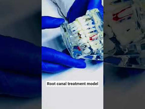 iDENTical Patient Education Model (Caries,implant,Nerves) M2001-3