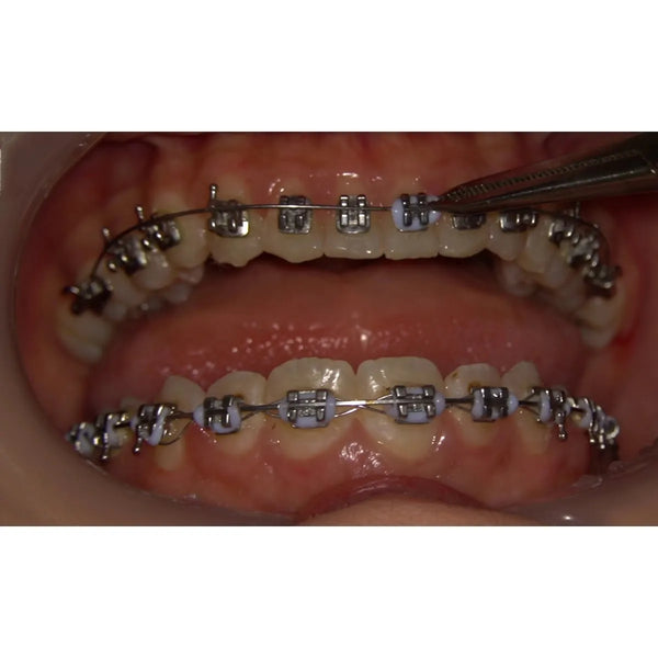 NITI ARCHWIRE REVERSE CURVED (ROUND)
