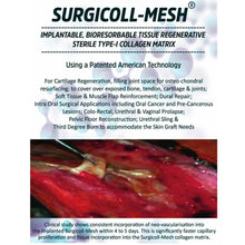 Advance Biotech Surgicoll Mesh