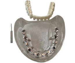 Paulo Malo Model for All-on-4 Implant Training and Prosthetic Practice