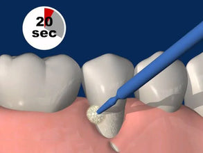 TOKUYAMA SHIELD FORCE PLUS - Glass Ionomer Cement