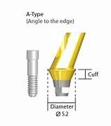 Angled Abutment Implant