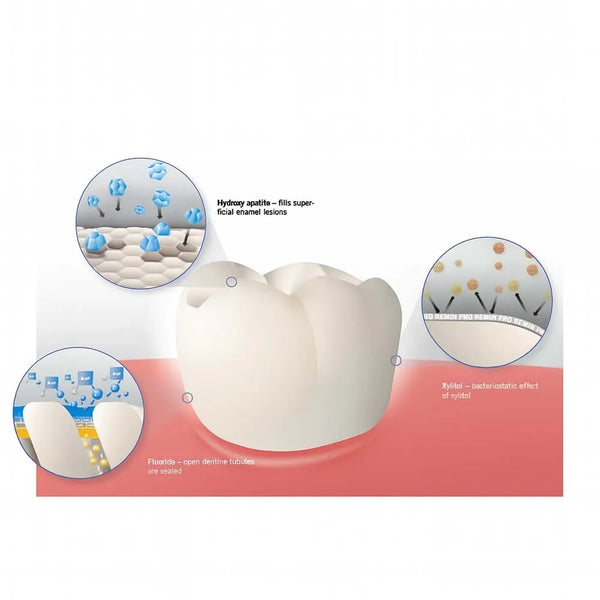 Voco Remin Pro Tooth Cream 40g | Fluoride – Dentalmantraa