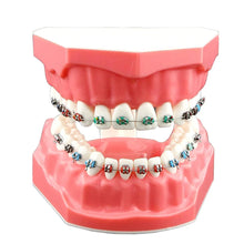 ORTHODONTICS ELASTICS